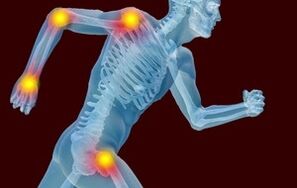 Arthrotes ve Arthroz'un gelişmesinin nedenleri